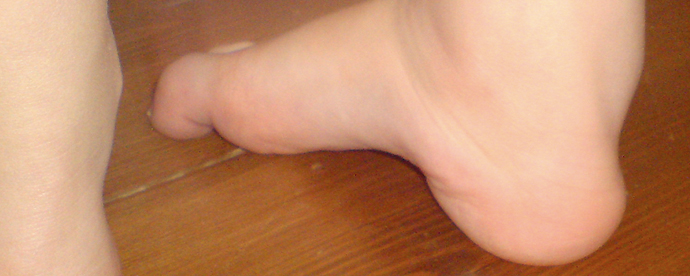 Mobility / Walking